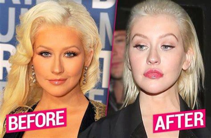 Christina Aguilera Plastic Surgery (20022020) YouTube