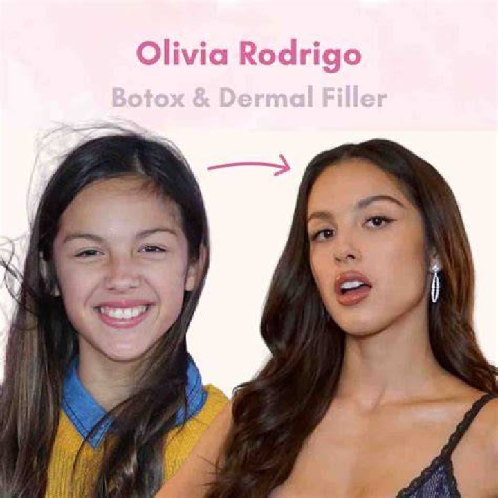 Did Olivia Rodrigo Get Breast Implants? Before And After Plastic Surgery Photos Compared
