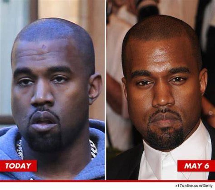 Kanye West Sympathy Bump [PHOTO]