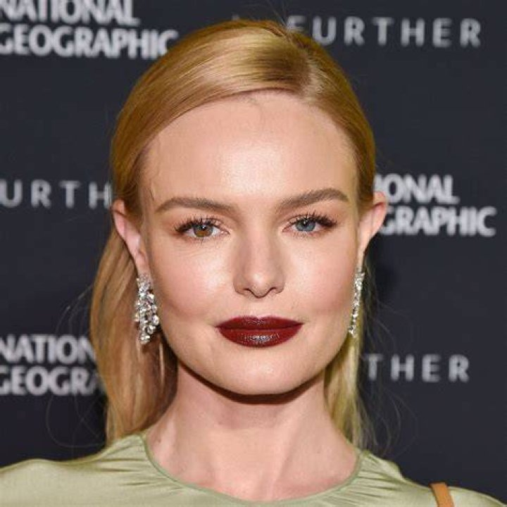 Kate Bosworth's Pregnancy: Unveiling Hope And Inspiration In Fertility Journeys