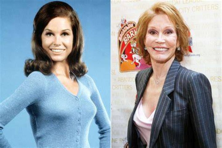 Mary Tyler Moore's Cause Of Death: Uncovering Hidden Truths