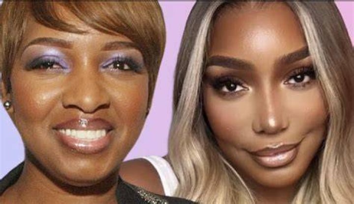 NeNe Leakes before & after plastic surgery 