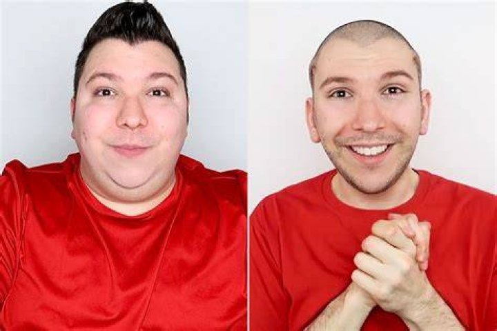 Nikocado Before And After Digital Global Times