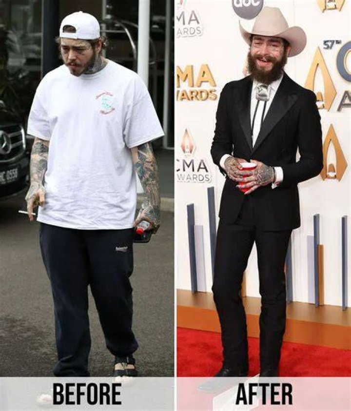 Post Malone Addresses Weight Loss Amid Concern Over His Health RapUp