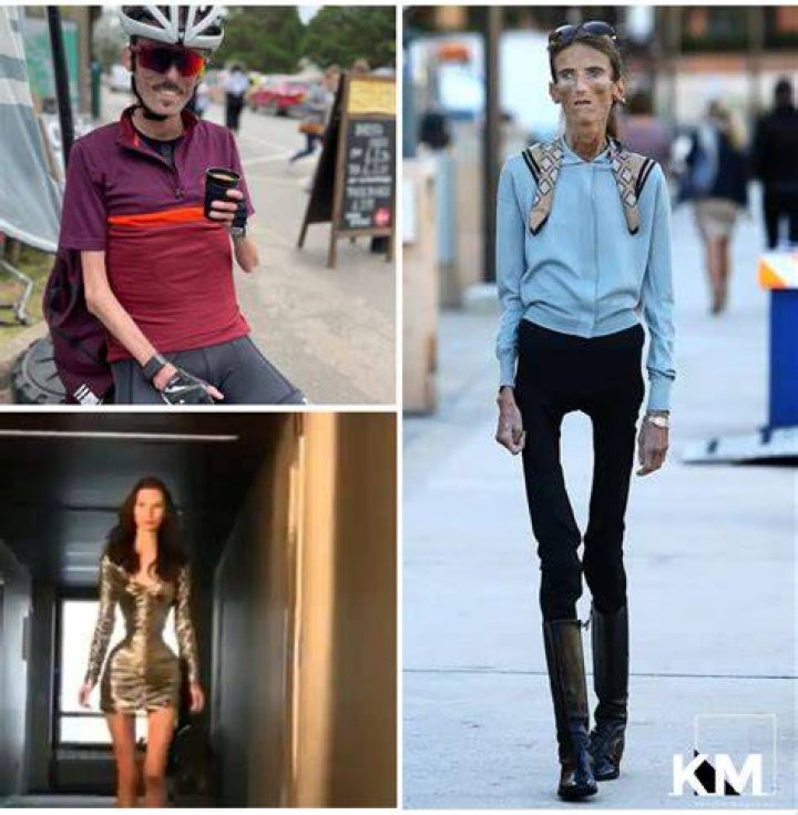 The Skinniest Person In The World 2022