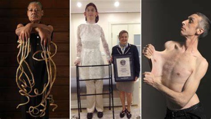 Uncover The Secrets Of The "5 Skinniest People In The": Unveiling Surprising Truths